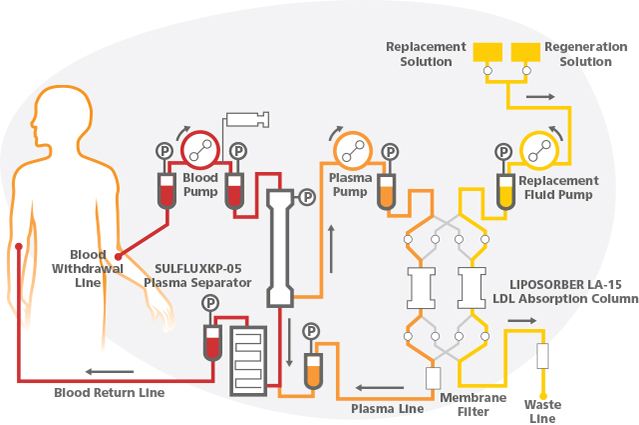 Apheresis process